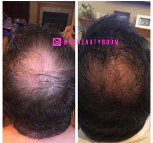 Scalp Consultation - KT BEAUTY BOOM